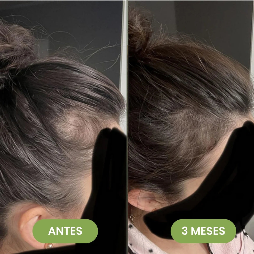 Serum Capilar de Crecimiento Intensivo 60 ml