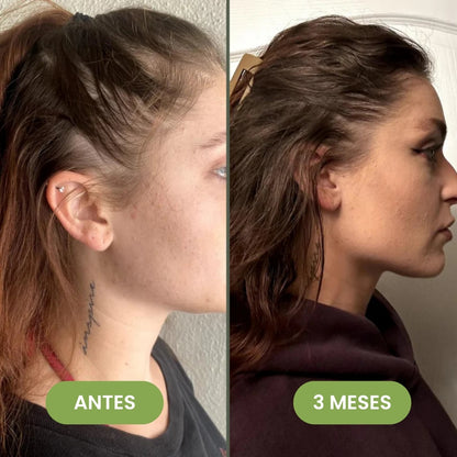 Serum Capilar de Crecimiento Intensivo 60 ml