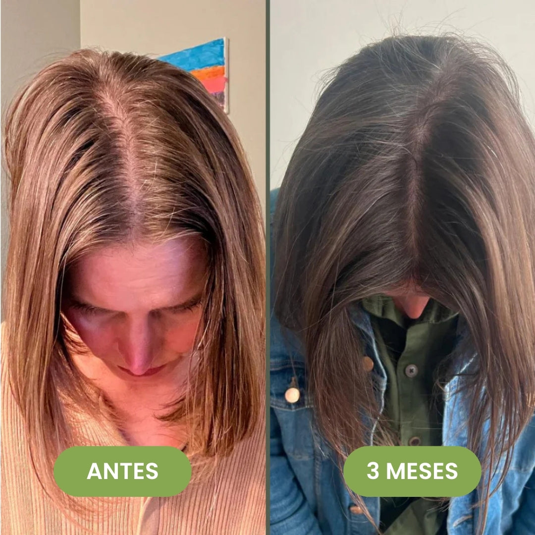 Serum Capilar de Crecimiento Intensivo 60 ml